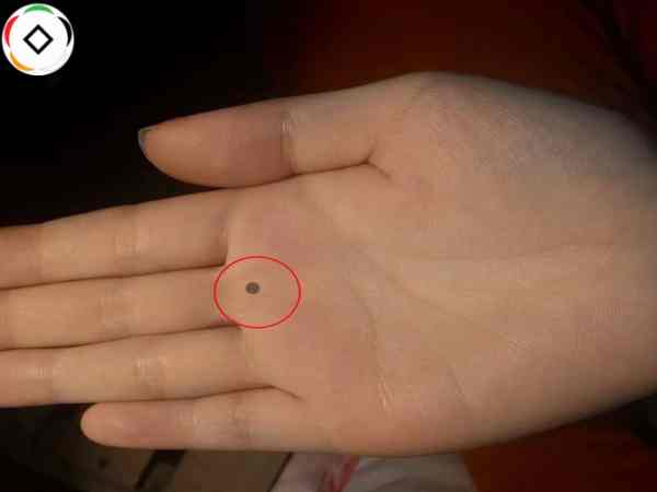 Nốt ruồi trên gò Thổ Tinh – Công danh gắn liền với gia tộc