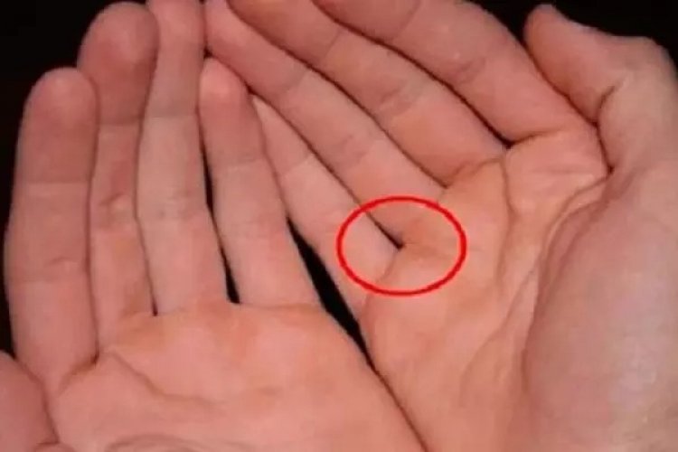 Khe giữa các ngón tay tiết lộ điều gì?