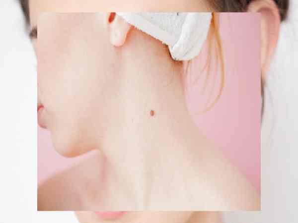 Chỉ ra 5 nốt ruồi mang quý nhân phù trợ số vận giàu sang