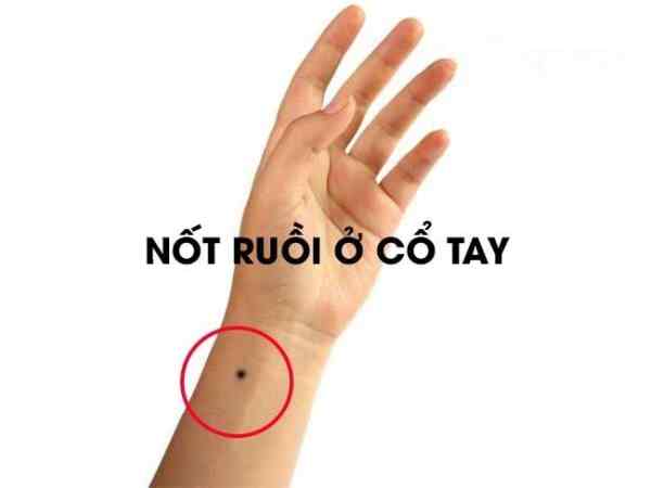 Nốt ruồi ở cổ tay trái phải bói vận mệnh, tình duyên