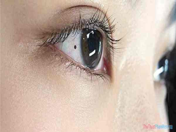 Đặc điểm tính cách của người có nốt ruồi trong mắt phải