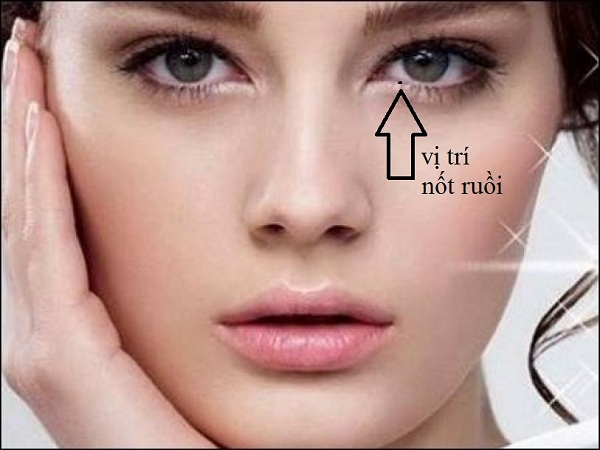 Nốt ruồi trong mắt phải có nguy hiểm hay không?