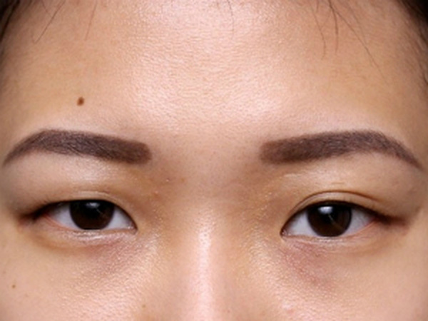 Tướng người có căn