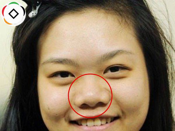 Giải mã tướng con gái có mũi to theo nhân tướng học?