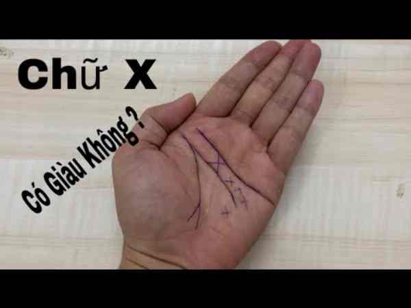 Bàn tay chữ X là gì?