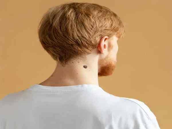  Nốt ruồi sau gáy bên trái nam – Tượng trưng cho sự kiên trì và phấn đấu