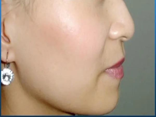 Sự nghiệp nữ mũi quặp: