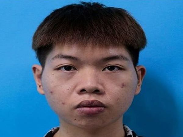 Tướng mũi hếch ở nam giới