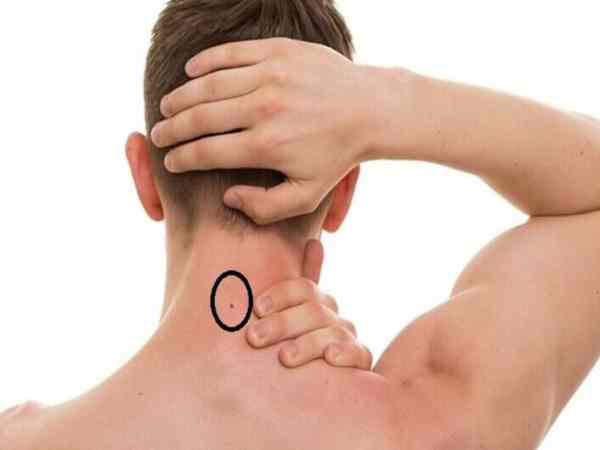 Nốt ruồi sau gáy chính giữa